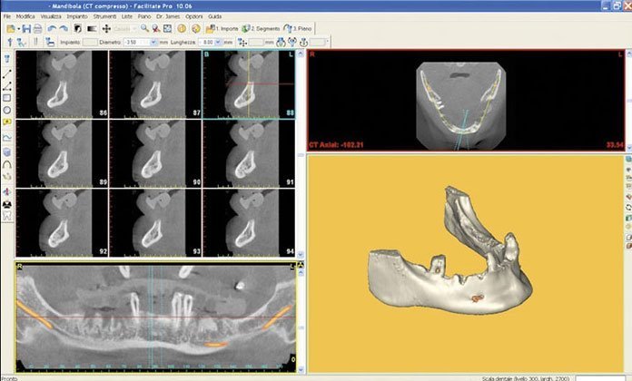 ortopantomografia - studio dentistico Orange Pordenone
