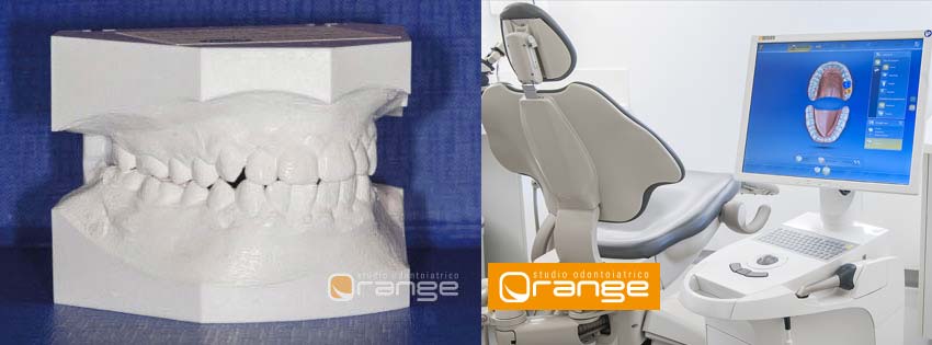 esami diagnostici scanner ottici e impronte - studio dentistico Orange Pordenone