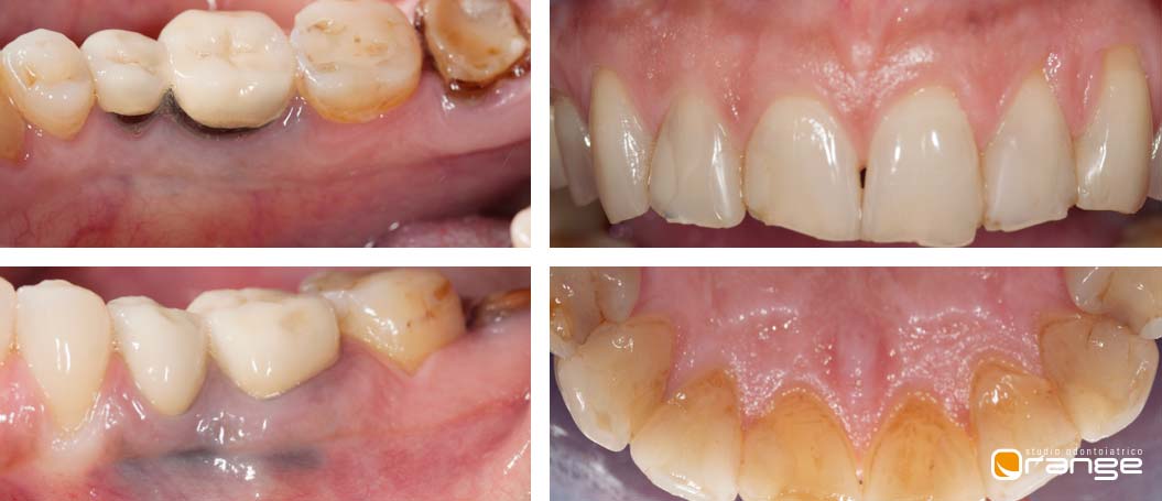 diagnostica - studio dentistico Orange Pordenone
