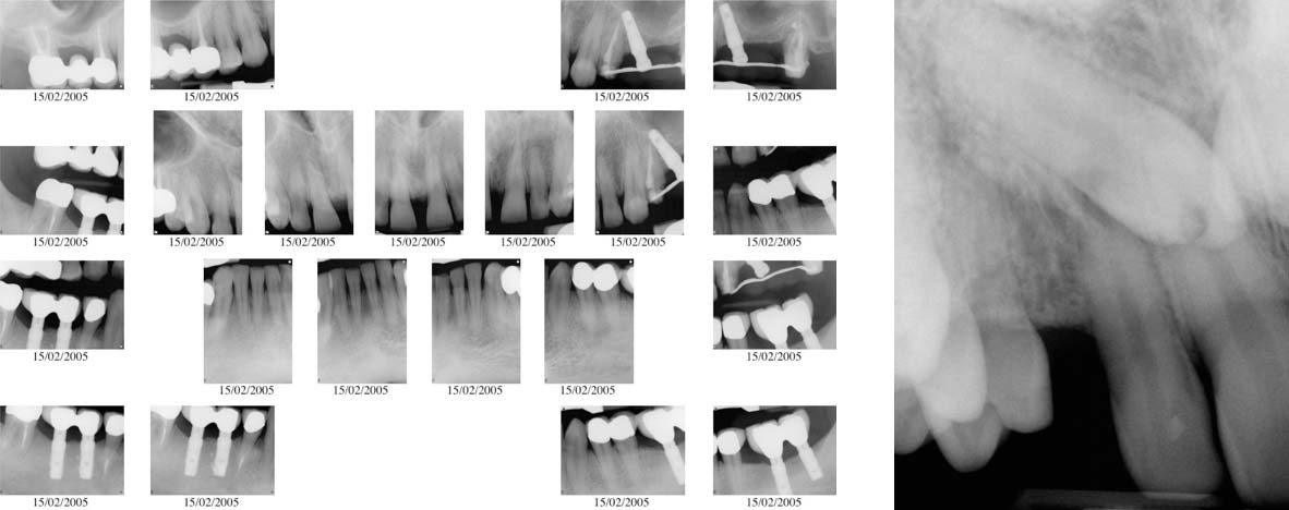 satus radiografico - studio dentistico Orange Pordenone